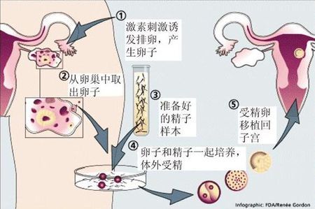 景泰生殖医学中心